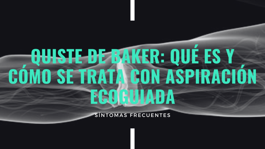 Negro Azul Panel Solar Energía Sol Blog Banner (4)